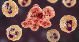 Musluk suyuyla sinüslerini temizlerken bulaştı, hayatını kaybetti